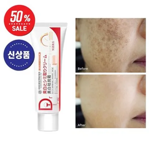 BT 기미크림 얼굴 색소침착 주름깨 기미잡티제거 미백크림, 1개, 38g