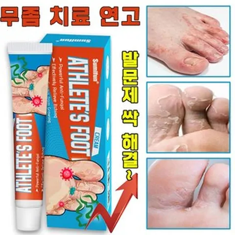 [국내 배송] 미국 발 무좀약 가려움 연고 무좀 습진 치료제 발냄새 제거 발바닥 발가락 가려움증 완화 크림 풋케어, 1개, 20ml