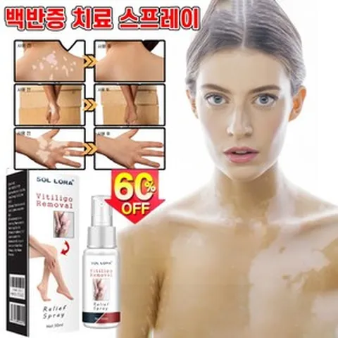 [독일기술] 1+1 얼굴 백반증 치료 스프레이 손 목 몸 피부치료 연고, 30ml, 1개