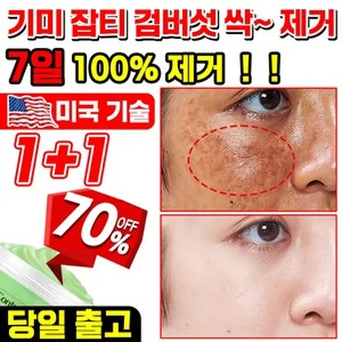 [국내배송] 1 / 1+1 기미 크림 기미 잡티 주근깨 검버섯 제거 크림 색소침착 케어 주름 미백 톤업 기능성 들깨 기미 크림 포장증정, 2개, 30g