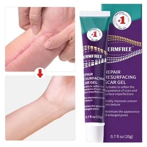 흉터제거연고 켈로이드흉터 제왕절개흉터 화상연고 화상물집 수술흉터 여드름흉터 색소침착흉터연고, 1개, 20g
