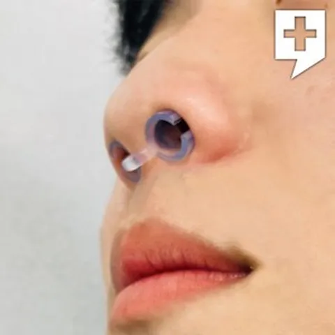 녹십자 그린닥터 비강확장기 코골이완화 코골이 방지 기구 특허받은제품 소형/중형/대형, 그린닥터 비강확장기(소형), 1개