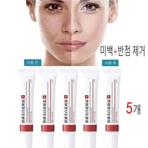 [정품 유효] 5개 화이트닝 주근깨 크림 기미 크림 제거 다크 스팟 제거 멜라닌 에이징 스킨 whitening freckle cream, 20g