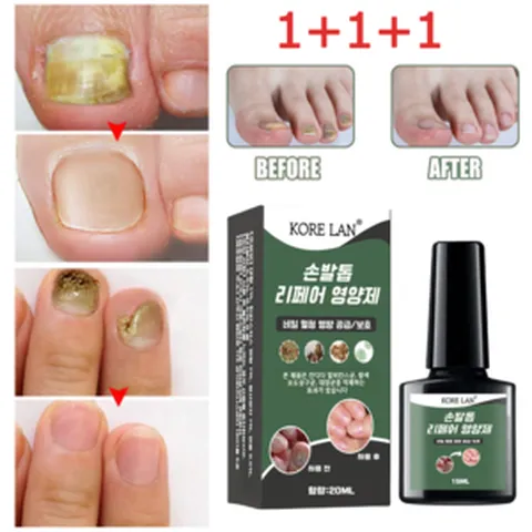 (국내산/당일발송) EELHOE 발톱무좀약 네일 발톱 영양제 관리 앰플 내성 곰팡이 살균, 3개, 20ml