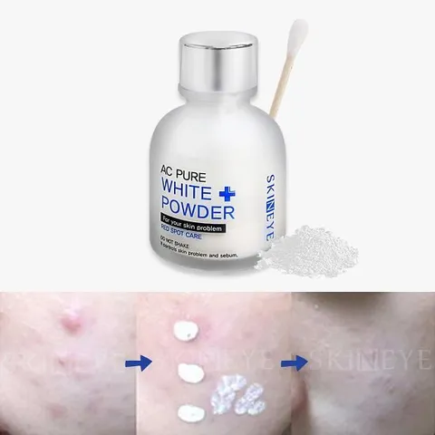 [스킨아이]S.O.S트 러블 스팟  화이트파우더