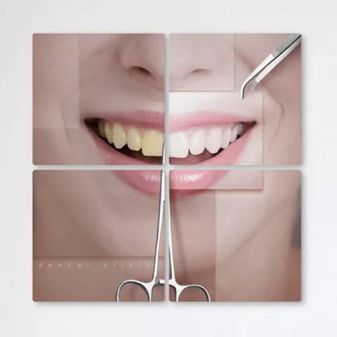 아트박스/꾸밈 tb388-멀티액자_미소가예뻐지는치아미백