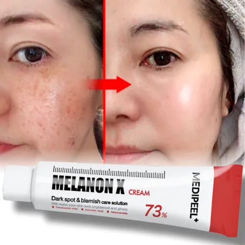 [사은품증정] 트라넥삼산크림 다크스팟크림 1위 검버섯제거크림 멜라토닝크림 연고 남자 기미 주근깨 제거 크림 피부색소침착제거 레틴A크림, 30g, 기미잡티크림, 1개