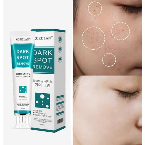 SMIATEY 검버섯 기미지우게 비타 e 미백크림 크림 검버섯 잡티, 20g, 1개