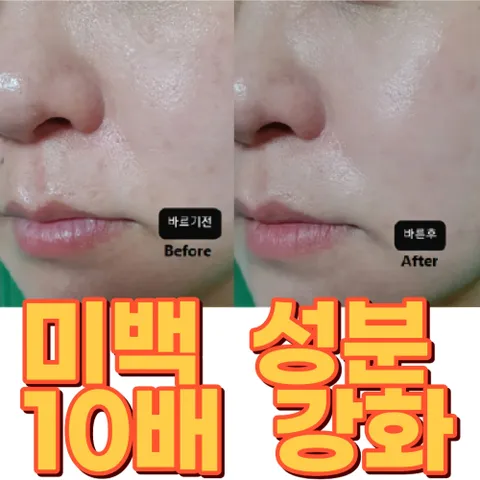 약국용 특허 기미잡티 검버섯크림/기미지우개 검버섯제거크림 기능성인증 반점제거 멜라닌 색소침착, 식약처 고시 화이트닝크림 1+1, 1개