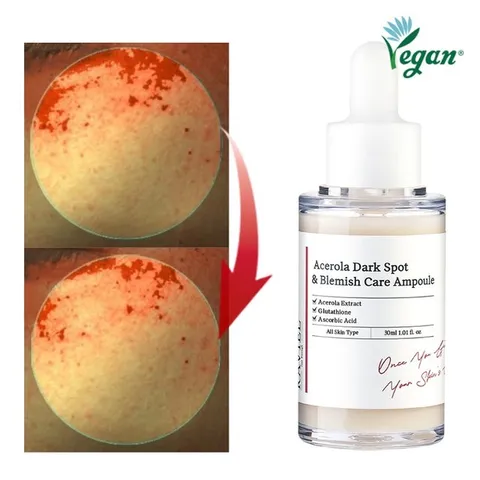 3일 개선 기미앰플 아세로라 잡티 기미 케어 앰플 30ml 저자극 임상완료