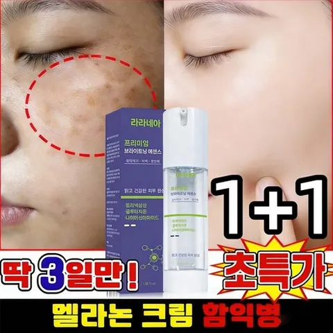 [당일 배송] 1+1/2+2 기미 크림1위 멜라논 크림 주름다나와세일 송채환 함익병 추천 기미잡티 개선 미백케어, 2개, 50g