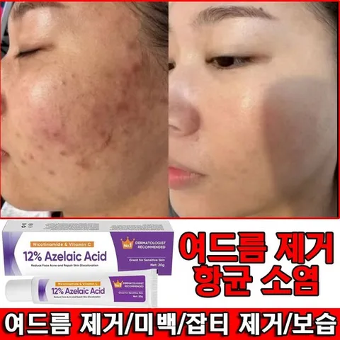 잡티 제거 크림 멜라논크림얼굴여드름색소침착개선피부톤미백 영양크림1위, 4개, 20g