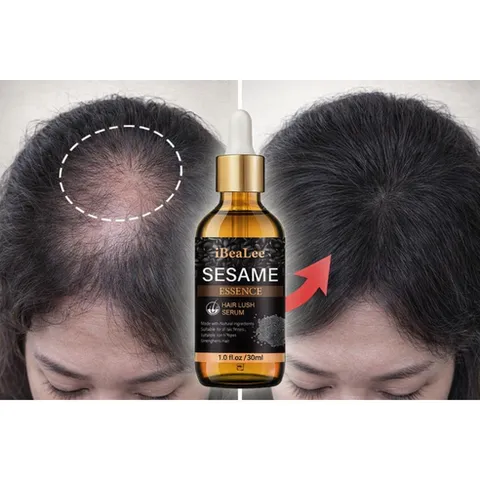 헤어에센스추천 탈모영양제 여성탈모 헤어에센스오일 폴리쉬 오일 두피앰플 컬링에센스 원형탈모 성장 모발 활력 증진 두피영양제 눈썹영양제 블랙속눈썹영양제 수염발모제, 1개, 30ml