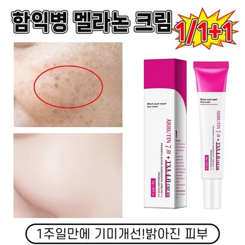 [당일출고] 1/1+1 멜라논 크림 함익병 기미잡티 제거 색소침착 미백 크림 고농축 흑자 집중개선 극추천ARBUTIN 7.0, 5개, 30ml