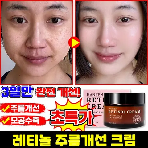 [100% 효과있음] 1/1+1/2+2 레티놀 크림 모공수축 크림 주름개선 재생크림 탄력 리프팅 미백 크림 미간 팔자주름 링클케어 수분크림, 1개, 32g