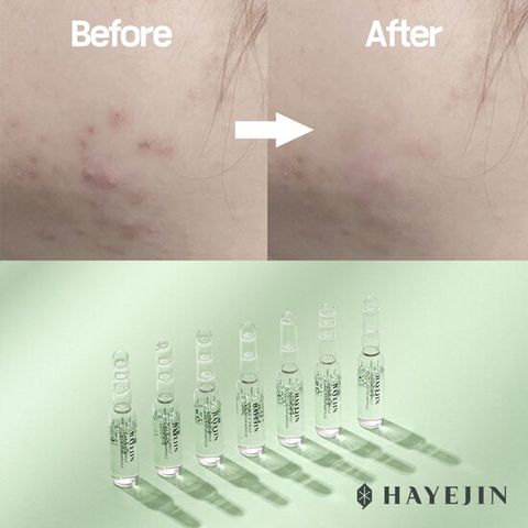 [하예진] 안색개선 시카풀 7days미라클 톤업앰플 2ml*7