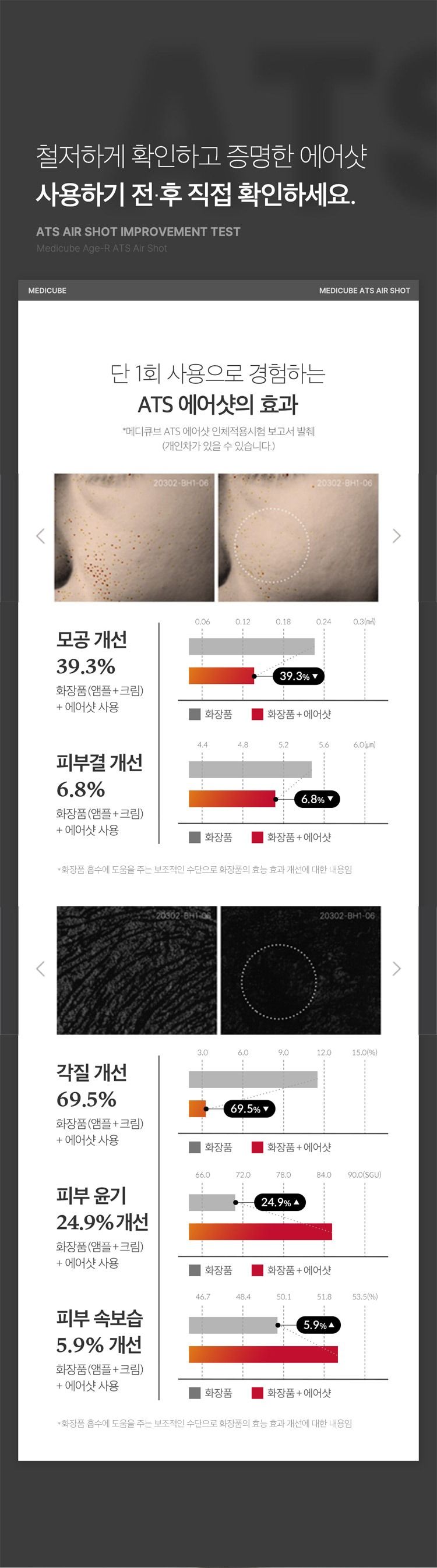 [정상가398,000원] 메디큐브 에이지알 모공 토닝 ATS에어샷