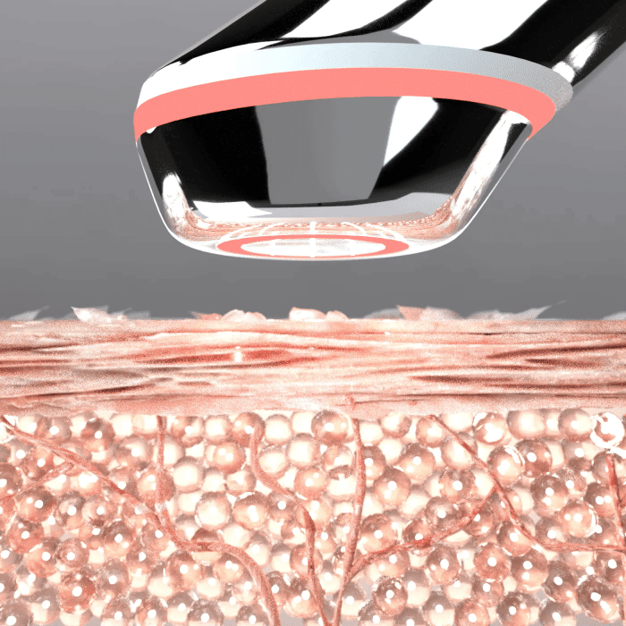 [정상가398,000원] 메디큐브 에이지알 모공 토닝 ATS에어샷