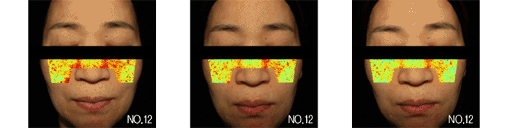 [도미나스] 크림4세대 기미미백크림 점보크림 점보앰플 점보구성