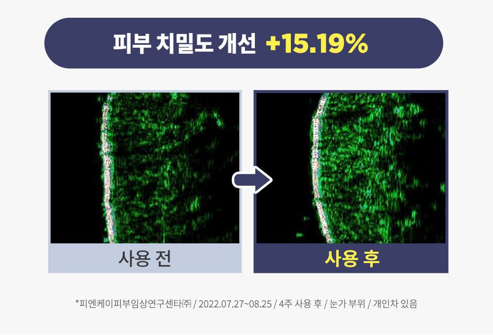 웰라쥬 최신상 리프팅 크림 런칭. [웰라쥬] 프로리프팅 크림 기본 패키지