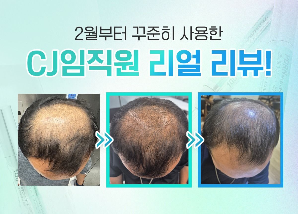 [구원더블패키지] VT PDRN리들샷 두피앰플 100 20개+브러쉬2개