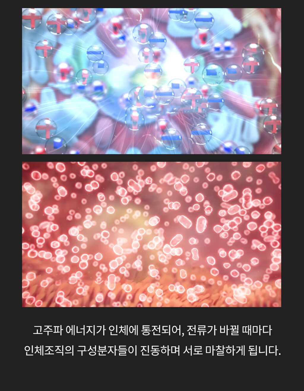 [렌탈] 자이글온 네스트 고주파 통증완화 의료기기