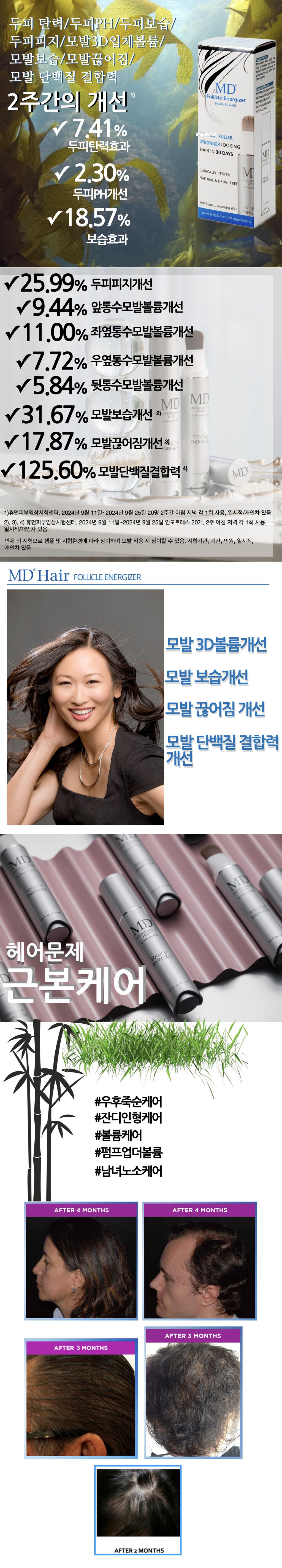 [미국 직수입 완제품] MD 폴리클 에너자이저 두피 세럼 1개