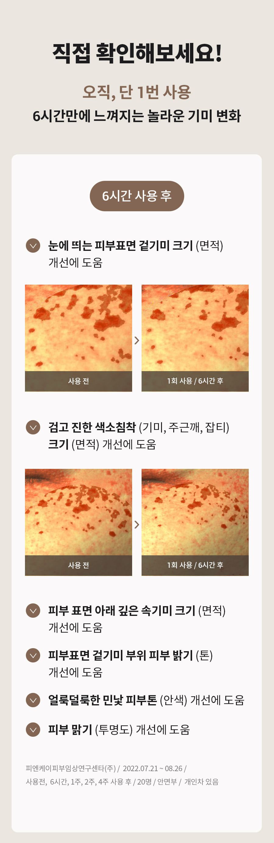 6시간 광속케어, 다음날 아침 환해진 피부 이민정 매스티나 그리스 수액 6시간 기미관리 앰플 10병세트