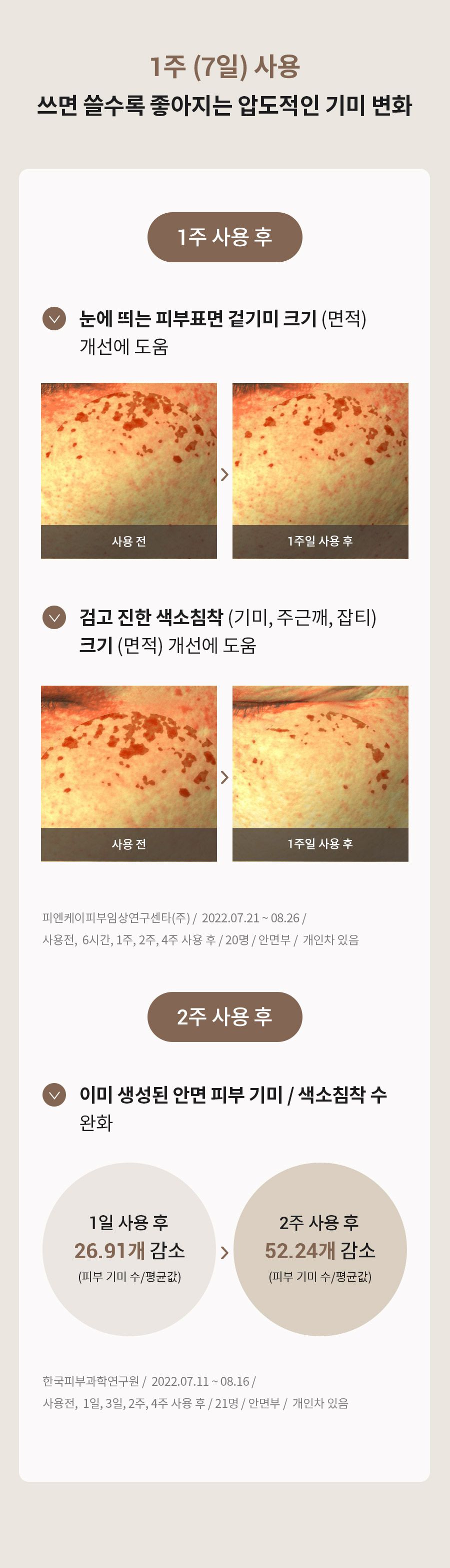 6시간 광속케어, 다음날 아침 환해진 피부 이민정 매스티나 그리스 수액 6시간 기미관리 앰플 10병세트