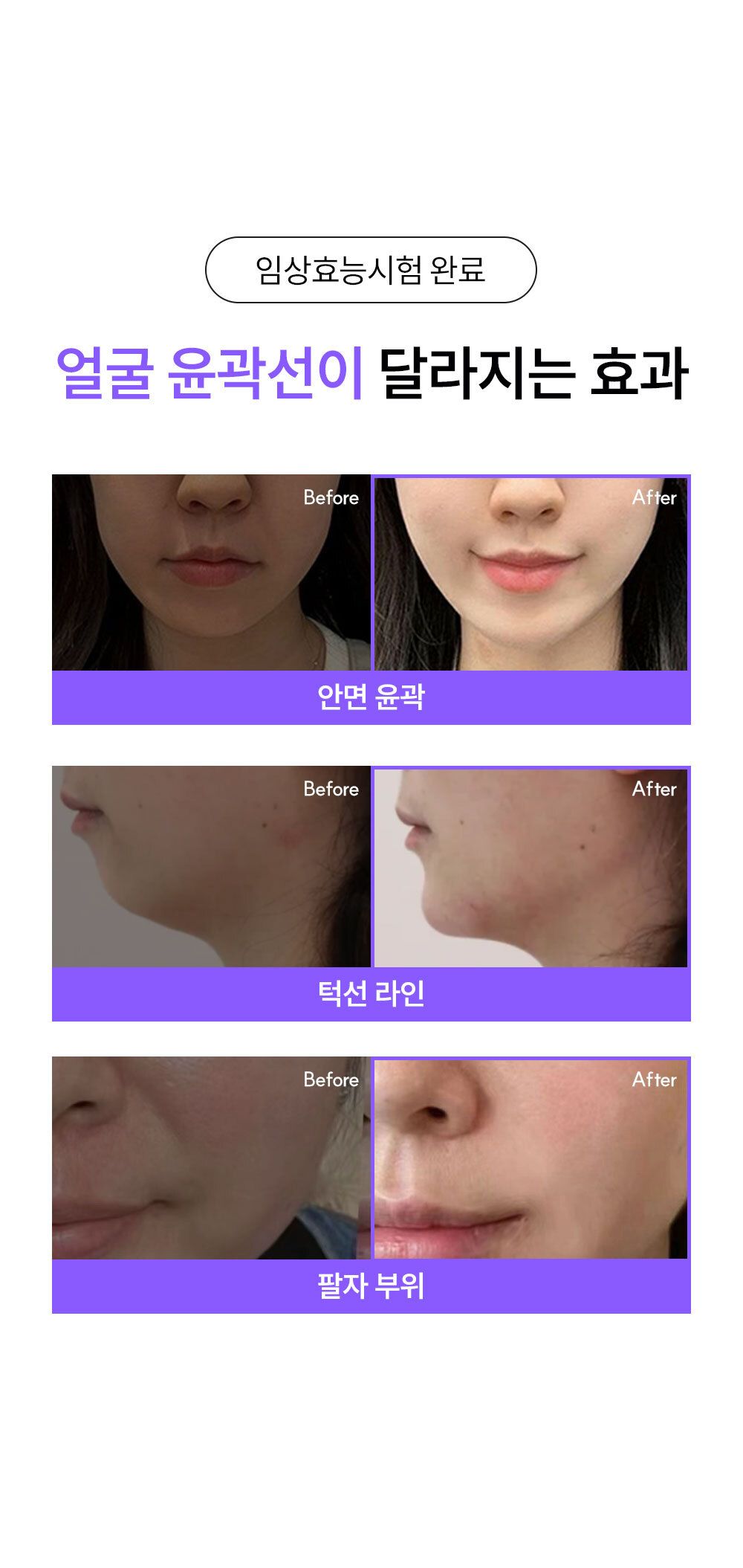 EOA 풀쎄라 프로 (기기 세트)