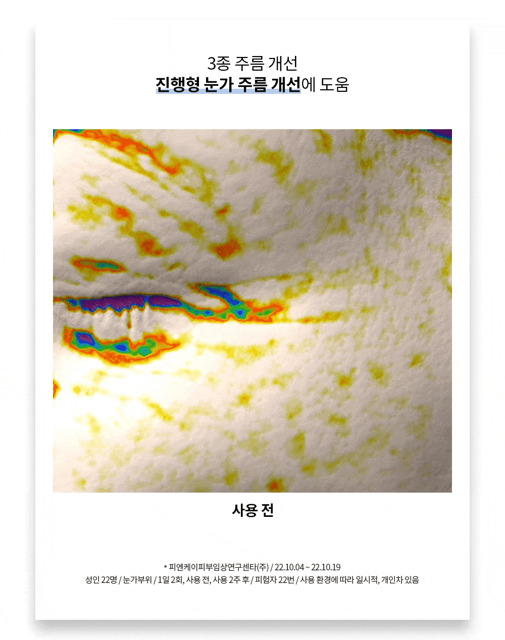 라비앙 미라클 스핑고좀 크림 50g 1통