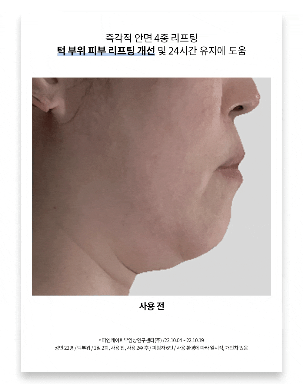 라비앙 미라클 스핑고좀 크림 50g 1통