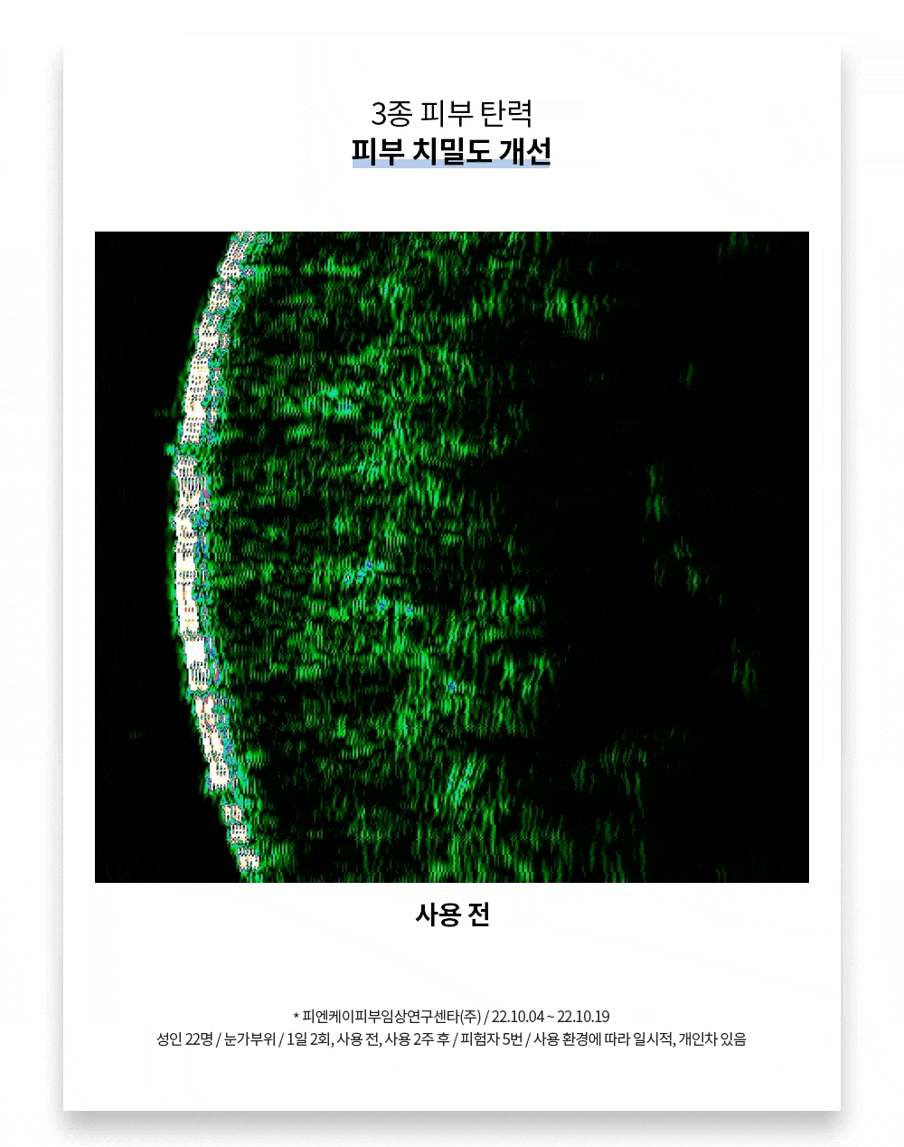 라비앙 미라클 스핑고좀 크림 50g 1통